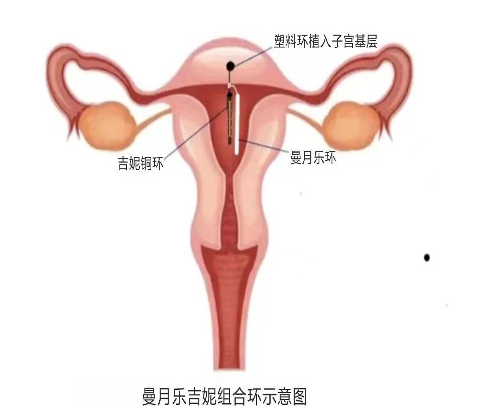 微信圖片_20240229143123.jpg 微信圖片_20240229143123.jpg